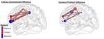 Executive Functioning and implicated brain recruitment distinctions in youth antisocial phenotypes