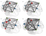 Brain network topology underlying socio-affective function and callous-unemotional trait