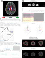 An analysis-ready and quality controlled resource for pediatric brain white-matter research